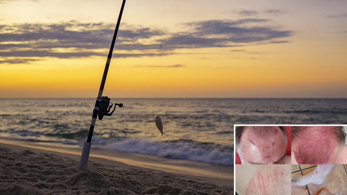  Pescador agredido por menas en Roquetas de mar