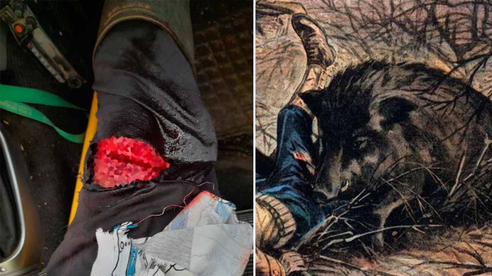 Un perrero cántabro recibe 20 puntos de sutura en la pierna tras el ataque de un jabalí