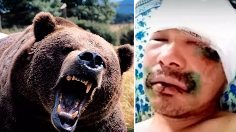Sobrevive al ataque de un oso mordiéndole la lengua cuando tenía la cabeza dentro de la boca del oso
