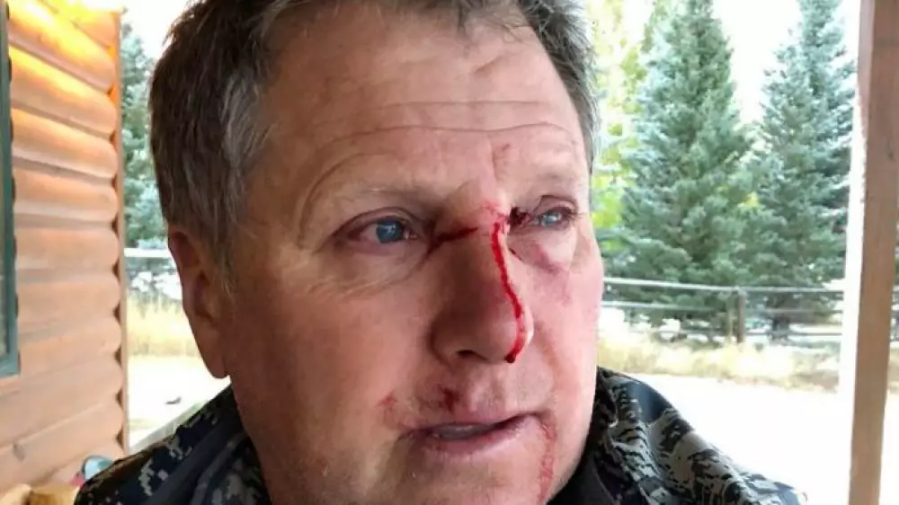 Una osa Grizzly ha atacado a un cazador de alces