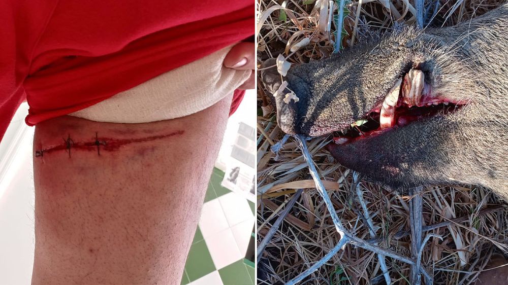 Los colmillos de un jabalí rasgan 18 centímetros la pierna de un cazador durante una espera