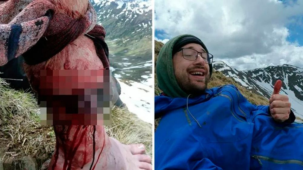 Un joven sobrevive a un brutal ataque de oso al darle un puñetazo