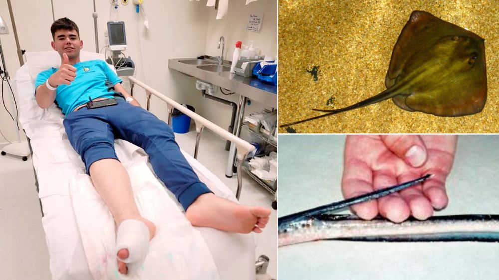 Un joven pescador, hospitalizado tras clavarse el aguijón de una mantarraya en el pie