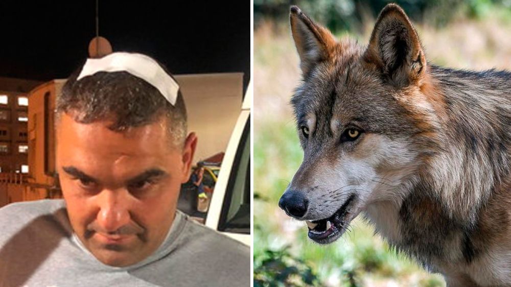Un cazador denuncia que ha sido atacado por lobos al defender a su perro: le mordieron en la pierna y en la cabeza