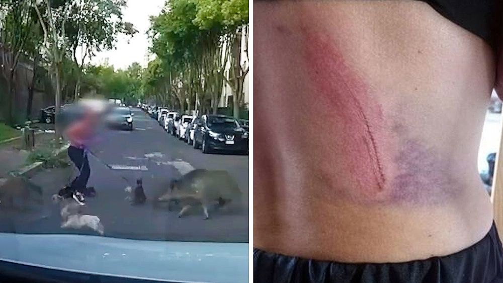 Aterrador ataque de un jabalí a una animalista que paseaba a sus perros por la ciudad